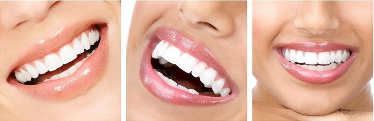 Tratamente cosmetice dentare: te ajuta sa te simti mai tanar